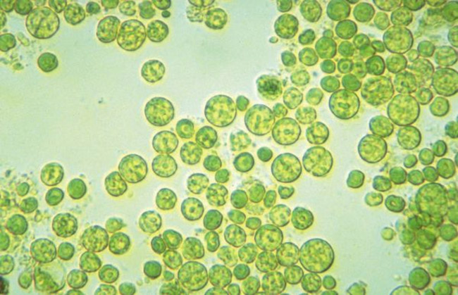 Tìm hiểu về “tảo lam dạng sợi” và “tảo lam dạng hạt”. Chúng gây độc cho ao nuôi tôm như thế nào? – Biogency